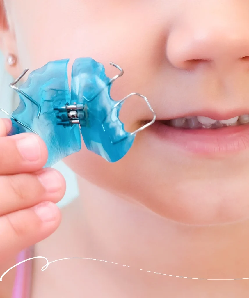 Early Intervention Orthodontics