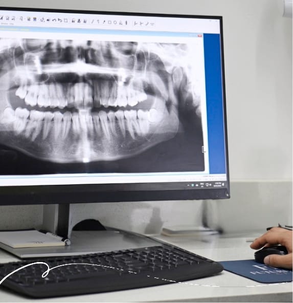 x-ray image for medical evaluation