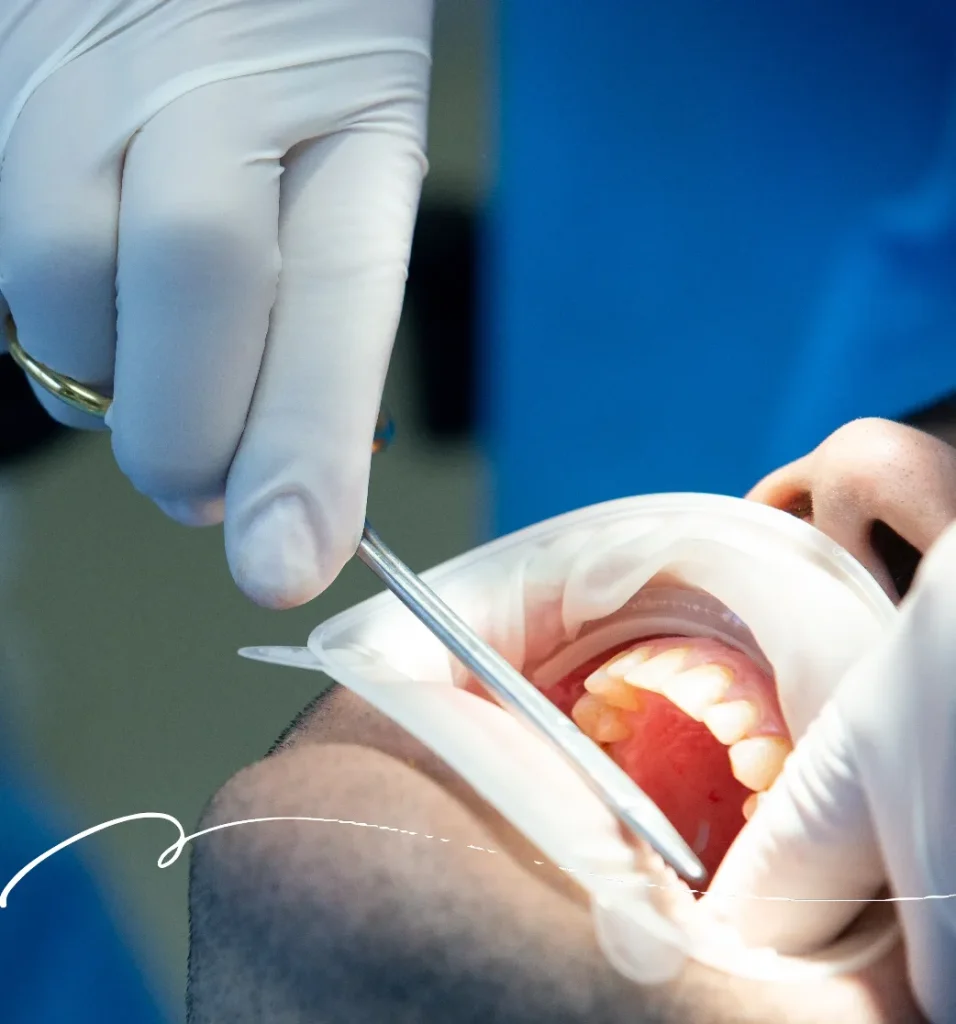 Moonee Ponds Full Mouth Implants