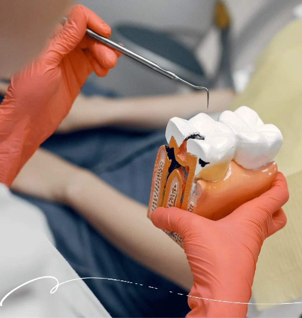 Root Canal Treatment Moonee Ponds