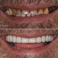 Dental Transformation Flemington