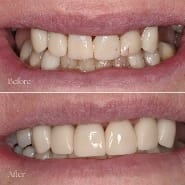 Dental Transformation Flemington