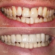 Dental Transformation 3 Flemington
