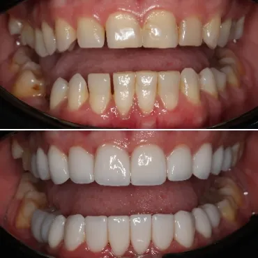 Dental Transformation 5 Flemington
