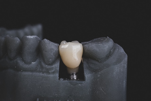 what are dental implants